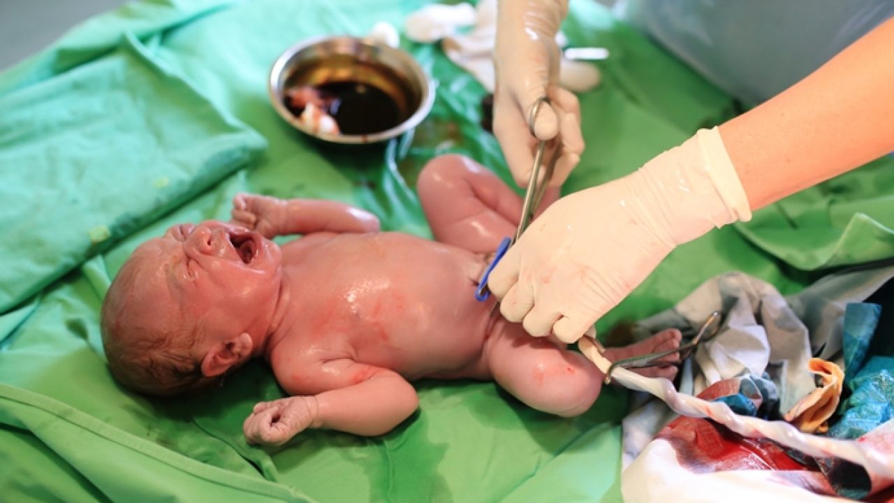 What To Do If Your Baby's Umbilical Cord is Bleeding